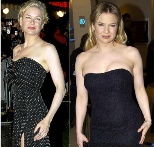 Renee Zellweger Weight Gain