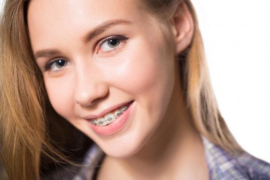 A beautiful girl is doing jaw correction treatment. She is happy and smiling