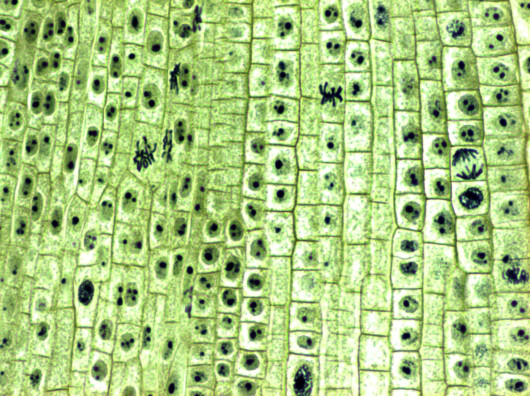 Plant stem under the microscope 