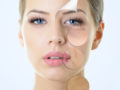 Girls face that shows signs of ageing: fine lines, wrinkles, sunken cheeks