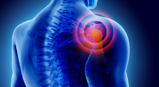 3D Illustration of shoulder painful, medical concept.