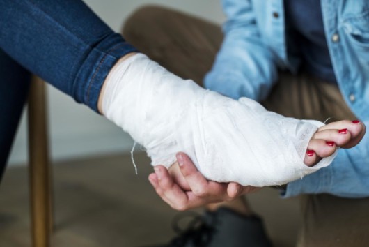 Girl's ankle in bandages due to the sprained ankle