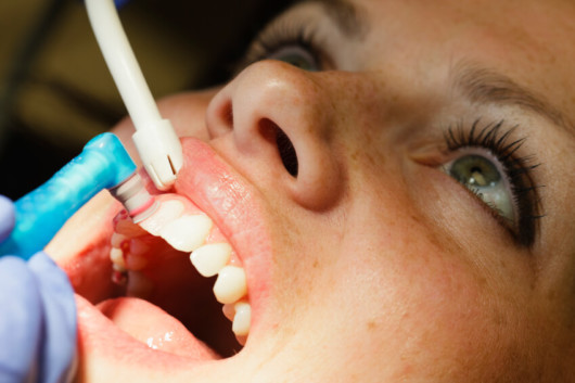 Dental cleanings are essential for the health of your teeth and gums