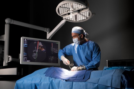 The frame for the MvIGS scan allows the surgeon to easily use an advanced 3D interface