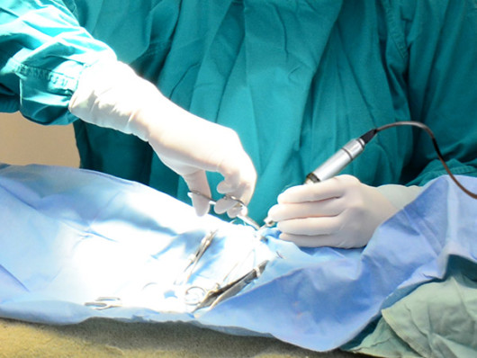 The surgeon is excising the cancerous cells to prevent the spread of the disease