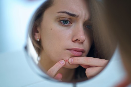 Girl in front of the mirror is trying to get rid of the pimple 