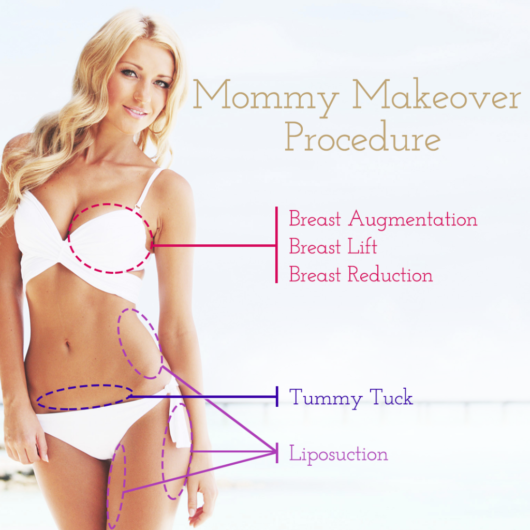 A girl demonstrates what mommy make over procedure can change in your body
