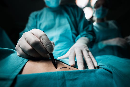 The surgeon puts the marks on the body before the operation