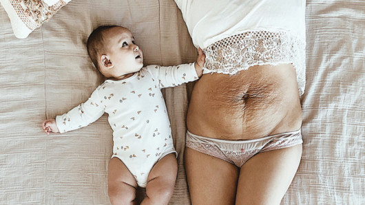 Mom With Loose Abdominal Skin After Giving Birth