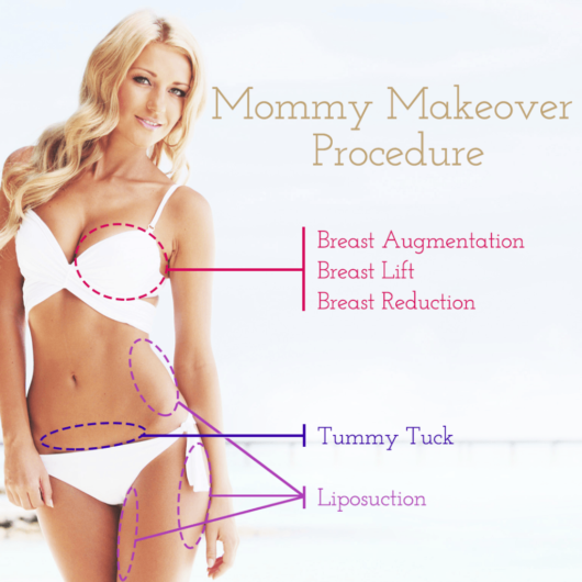 Beautiful girl in a swim suit shows that during mommy makeover procedure you can do breast augmentation, tummy tuck and liposuction