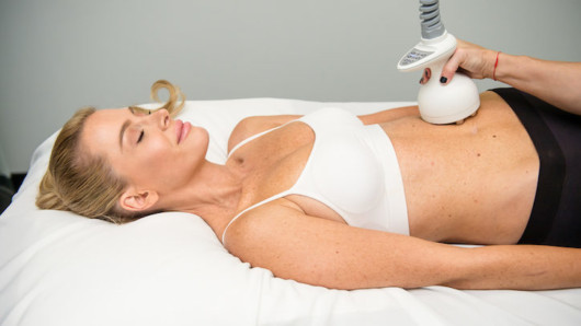 A beautiful girl is lying on the white bed and the doctor is using Octi Polar applicator on her belly 