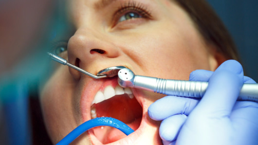 Girl at the dentist checks up her teeth