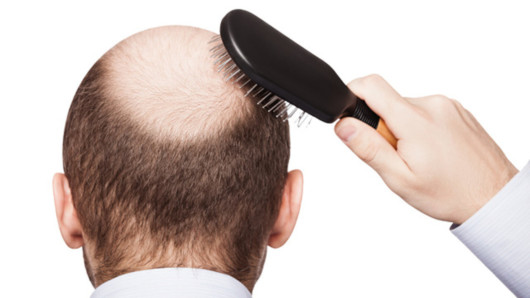 A man isolated on white standing with his back to the camera brushing his hair that is bolding  