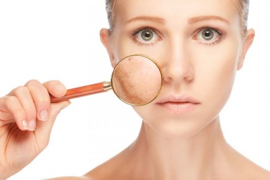 A close up girl's face on white. The girl is holding a hand lens close to her skin to show the imperfections