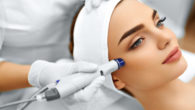 A doctor is doing Potenza™ Radiofrequency Microneedling to the girl