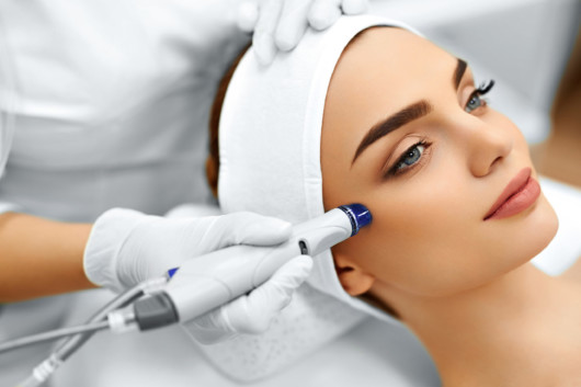 A doctor is doing Potenza™ Radiofrequency Microneedling to the girl