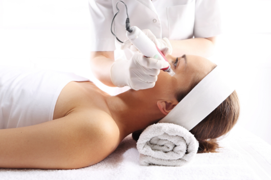 A girl Id lying on the white bed and the doctor is doing Potenza Radiofrequency Microneedling on her face