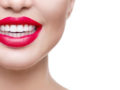 A close up picture of a girls mouth on white with red lipstick and perfect white teeth