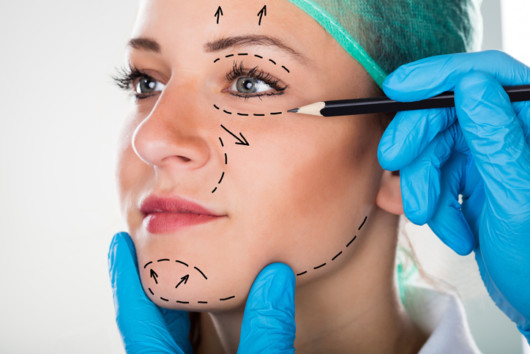 A close up girl's face with doctor's preparation marks for facelift surgery