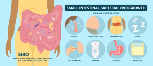 A picture os a girl with enlarged unhealthy gut and symptoms of SIBO