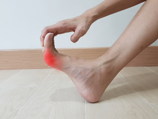 6 Essential Tips for Treating Gout