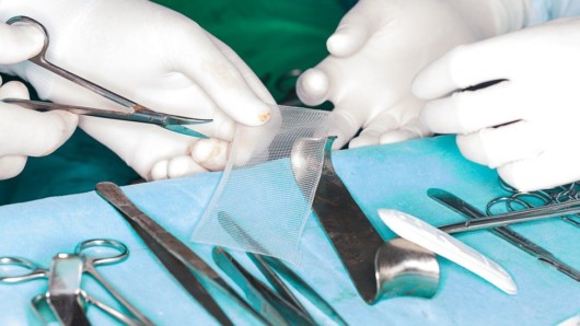 A surgeon is cutting a piece of hernia mesh during the hernia mesh operation