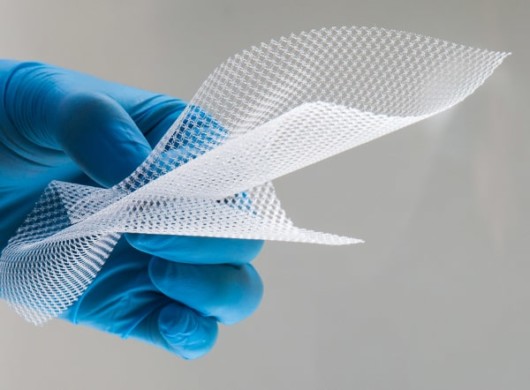 A doctor in blue rubber glove is holding surgical mesh to treat hernia