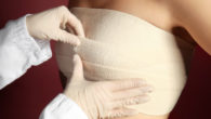 A doctor is putting a post surgical bandages on the girl's breast after the breast augmentation procedure