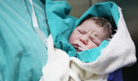 An obstetrician is holding a newly born baby