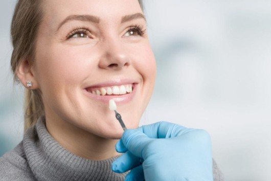 A dentist is choosing veneer for the girl