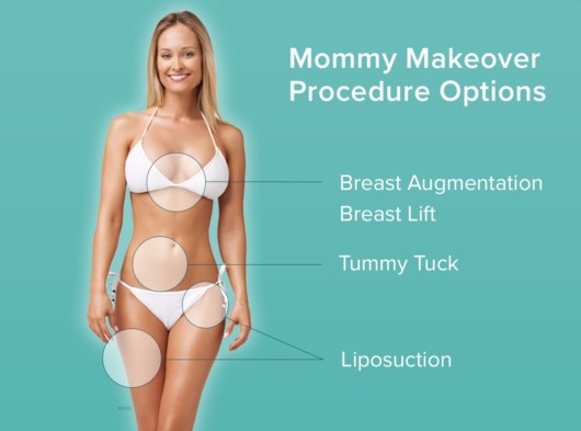 An image of a woman with a beautiful body that shows what can be change during mommy makeover procedure