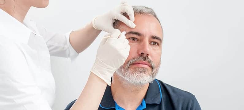 A doctor is doing Mohs surgery on the man's face