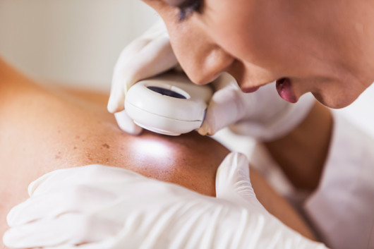 A doctor is checking the mole on the girl's back