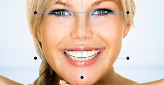 A close up picture of a girl's digital smile design