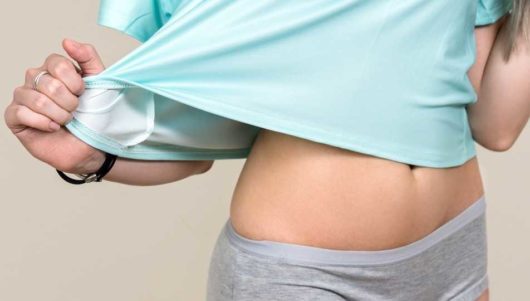 Abdominoplasty in Tampa, FL: The Definition, Cost, Procedure, and Recovery