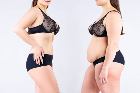 An image of a girl in black lingerie on grey background before and after the body lift
