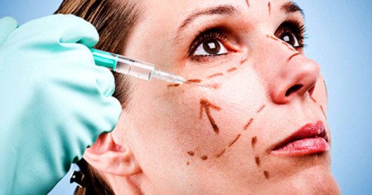 A close up woman's face with doctor's marks before the cosmetic surgery