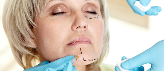 A doctor is doing facelift injections to a woman