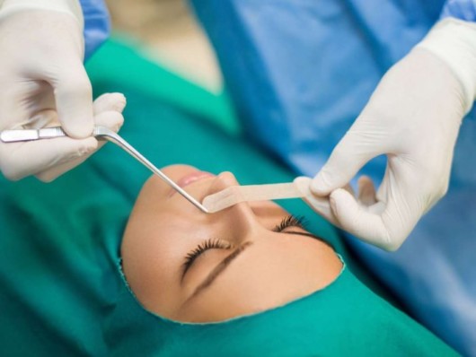 A surgeon is performing rhinoplasty to the girl
