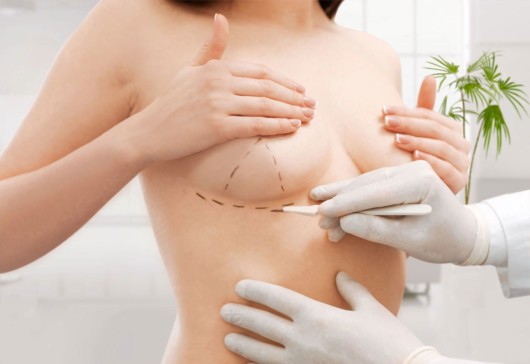 A doctor is putting marks under the girl's breast before the breast reduction