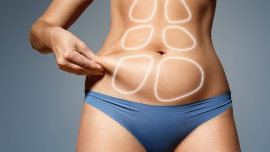 Liposuction Questions You Need to Ask Your Plastic Surgeon