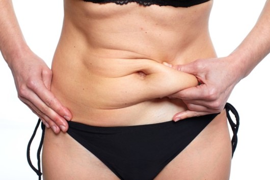 Mini Tummy Tuck: Is It Worth It?