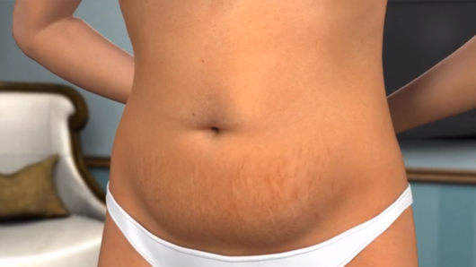 A close up picture of a woman in white underwear with a belly