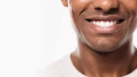 A guy on white is smiling and showing his white teeth