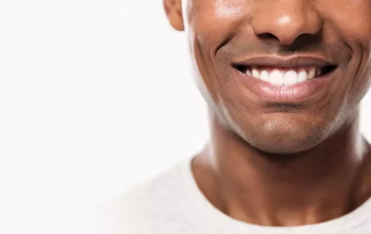 Benefits of Veneers: Improve Your Smile With Cosmetic Dentistry
