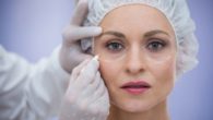 Plastic surgeon is drawing marks on lady's face before plastic surgery
