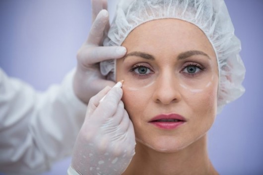 Plastic surgeon is drawing marks on lady's face before plastic surgery