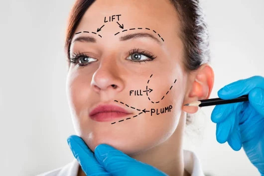 Facelift Surgery: Everything You Need to Know in 2022