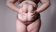 A woman with excessive weight in beige underwear on grey background holding her big belly