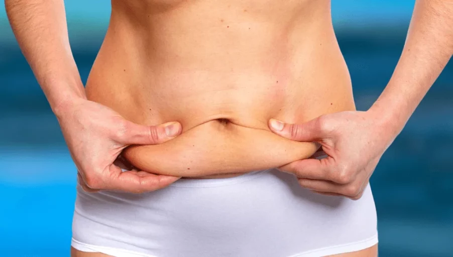A close up image of a woman belly with excessive fat. She is pinching her fat belly with her fingers.